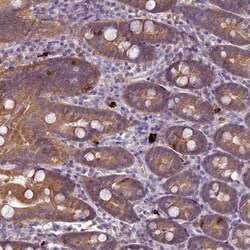 CD161 Antibody, Novus Biologicals 0.1mL; Unlabeled:Antibodies, Polyclonal